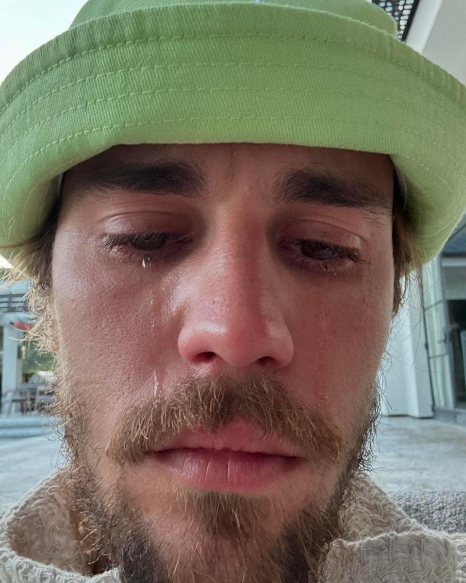 Justin Bieber appears contemplative in a recent 2025 image, exemplifying the question what happened to Justin Bieber
